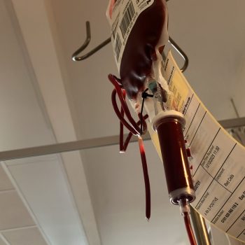 My first red blood cell transfusion